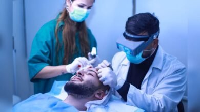 صورة توضيحية - Tito center نتائج مبهرة على مستوى زراعة الشعر