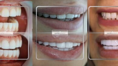 عيادة الدكتور حبيب ظريفه Ferrari Dental Clinic by Smile Infinity سبيلك الفريد للحصول على ابتسامة ساحرة
